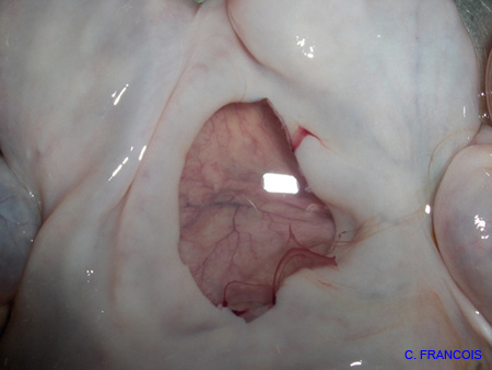 massecol_tumeurovaire_pseudogest_hyperplasieglandulokystique_ov (22)