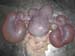 massecol_tumeurovaire_pseudogest_hyperplasieglandulokystique_ov (6)