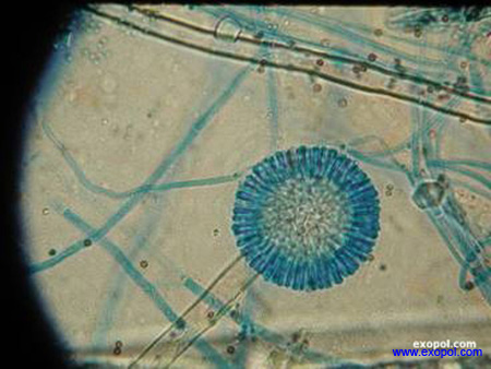 aspergillus_spp_exopol