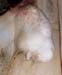 chapelet_abces_sagital_ov3