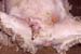 mc_gangreneuse_debut_cicatrisation_ov