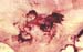 mc_gangreneuse_necrose_ov2