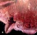 mastite_aiguë_staph_coag_plus_ov_ceva