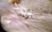 mc_gangreneuse_cicatrice_mastectomie_ov
