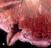 mastite_aiguë_staph_coag_plus_ov_ceva