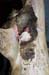 mc_gangreneuse_phase_finale_atteinte_abdominale_ov