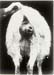 cp_recul_uterus_gravide (1)