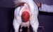 cp_recul_uterus_gravide