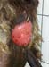 prolapsus_vaginal_bascobearnaise