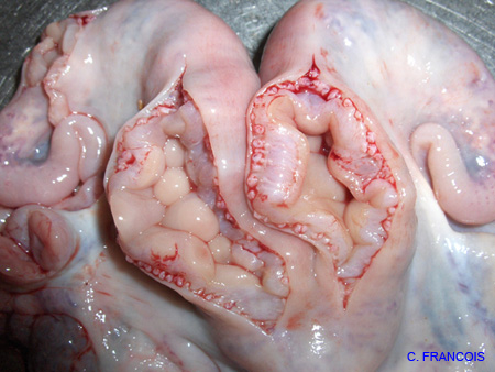 uterus_endometrite (4)