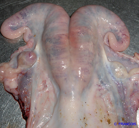 uterus_endometrite