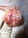 massecol_tumeurovaire_pseudogest_hyperplasieglandulokystique_ov (15)2°ovaire