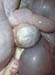 massecol_tumeurovaire_pseudogest_hyperplasieglandulokystique_ov (8)