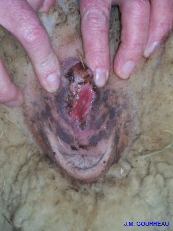 Dermatose ulcéreuse Vulve Champignelles 02 Janv.06 