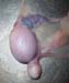aspect_testicule_abdominal_ov