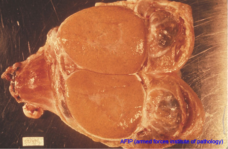 brucellose_epididymite_AFIP_ov