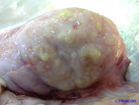 epididyme_suppure_ov