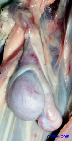 epididymite_jeune_ov