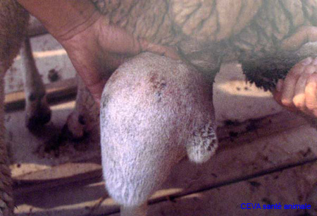 epididymite_orchite_ov