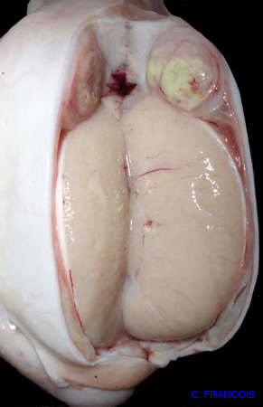 epididymo-orchite_ov