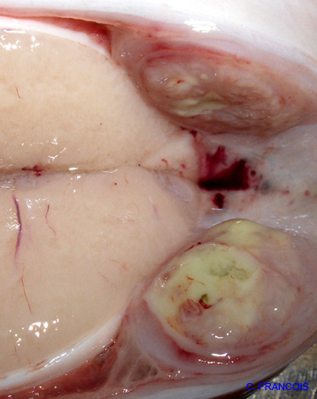 epididymoorchite_grosplan_ov