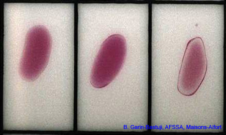 epreuve_antigene_tamponne2