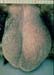 orchiepididymite_jm-blasco_cita_saragosse2