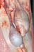 orchiepididymite_unilaterale_ov