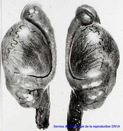 cp_granulomes_spermatiques_bilat_tete_epididyme