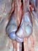 hypoplasie_test_bilat_ov