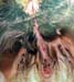 bifurcation_scrotale_ceva