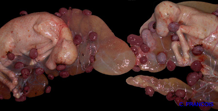 gestation_gemellaire_mixte_ov