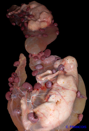 gestation_gemellaire_mixte_ov3