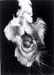 cp_pseudohermaphrodisme_clitoris_peniforme_pathorepro